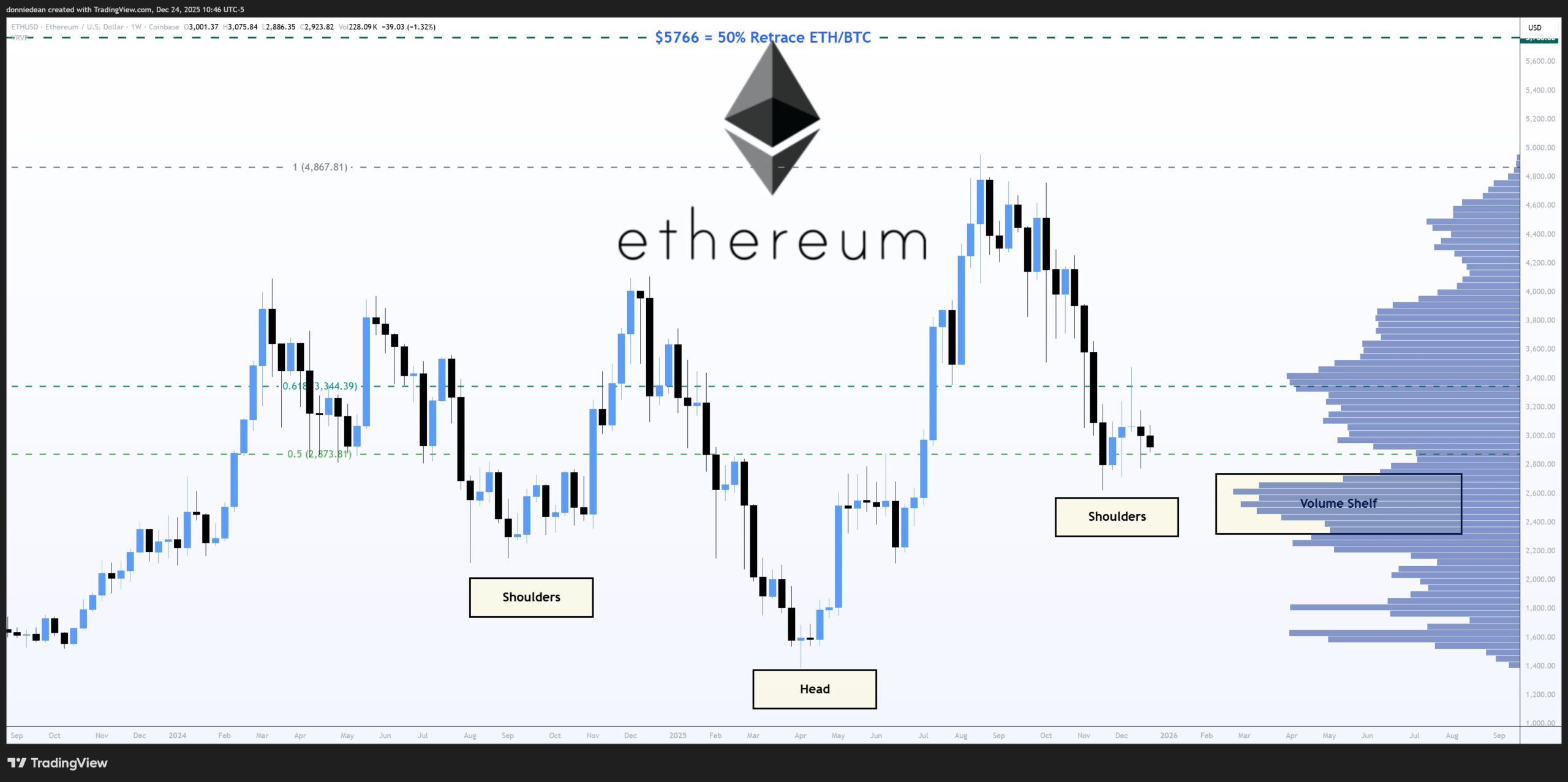 Ethereum Inverse Head and ShouldersSource: TradingView, Coinbase